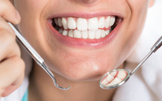 Реставрация зубов: восстановление красоты и здоровья
