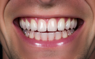 Замена зубных имплантов: на что нужно обратить внимание?