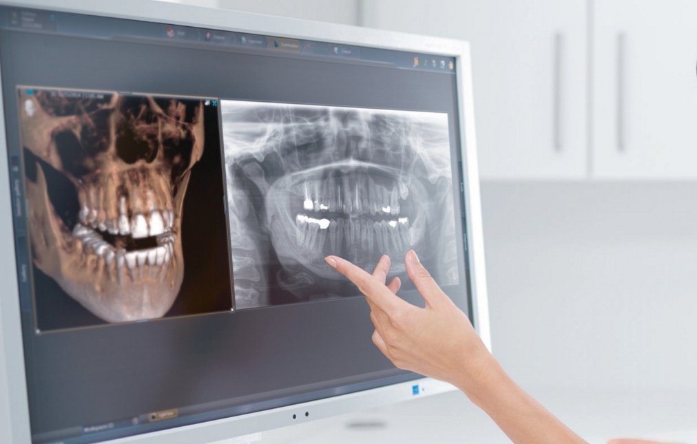 Обзор принципа работы 3D томографии