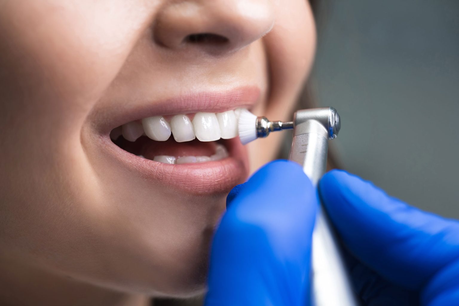 Отбеливание зубов в стоматологии: эффективные методы и советы